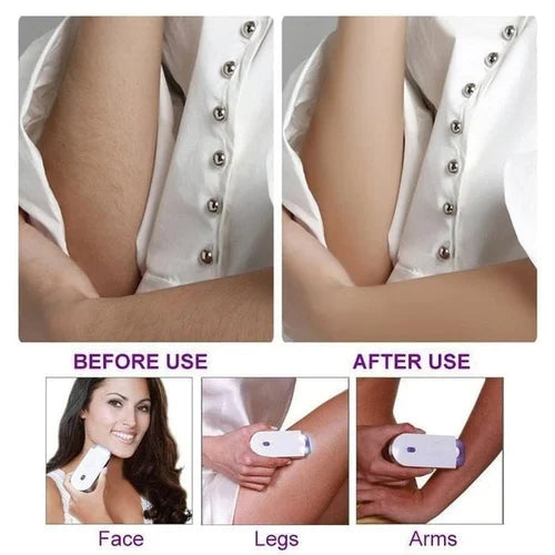 š Imported⢠Yes Finishing Touch Face Body Instant Pain Free Hair Removal