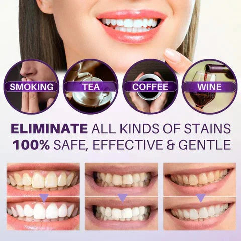 HiSmile V34 Teeth Whitening Serum